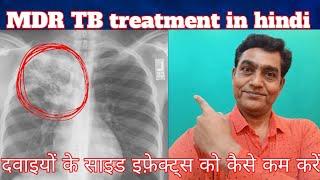 Mdr tb treatment in hindi