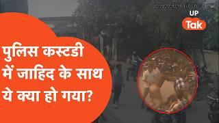 Siddharthnagar Crime: Police कस्टडी में भी जाहिद को दबंगों ने नहीं छोड़ा, किया ये हाल...