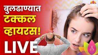 Baldness Virus in Buldhana LIVE Update : बुलढाण्यात टक्कल व्हायरस  | Marathi News