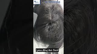 Miraj Hair Patch In Delhi | Best Hair Patch In Delhi