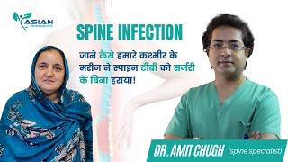 जाने कैसे हमारे कश्मीर के मरीज ने स्पाइन टीबी को सर्जरी के बिना हराया! Spine Doctor | Dr. Amit Chugh