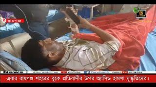 এবার রায়গঞ্জ শহরের বুকে প্রতিবাদীর উপর অ্যাসিড হামলা দুস্কৃতিদের।