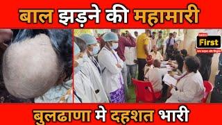 बाल झड़ने की महामारी बुलढाणा मे दहशत भारी| #buldhananews | NEWS FIRST