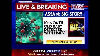 Assam reports first HMPV case, 10-month-old child tests positive in Dibrugarh