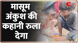 मासूम अंकुश की कहानी रुला देगा | Emotional Story of Ankush | Bhagalpur Flood | Bihar | Poor Kids