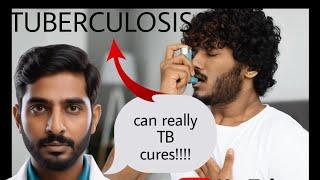 टीबी (Tuberculosis) की पूरी जानकारी | लक्षण, कारण और उपचार || BY REGISTERED PHARMACIST || ARMAAN