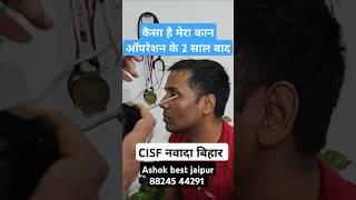 कैसा है मेरा कान ऑपरेशन के 2 साल बाद नवादा के CISF जवान ? #ashokbest jaipur 88245 44291 👂