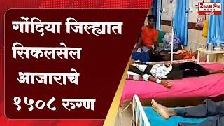 GONDIA | गोंदिया जिल्ह्यात सिकलसेल आजाराचे 1508 रुग्ण