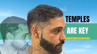 Hair Transplant in India |for Sikh pattern traction alopecia