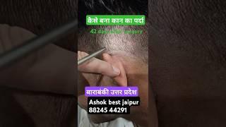 कैसा बना मेरा कान का पर्दा ऑपरेशन के 42 दिन बाद ? बाराबंकी के सैनिक #ashokbest jaipur 88245 44291 👂