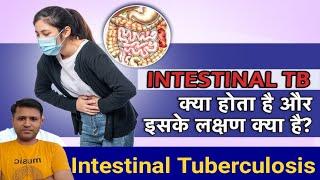 Intestinal TB क्या होता है? | Intestinal TB  के लक्षण क्या है? | आंतों की टीबी की जांच कैसे होती है?