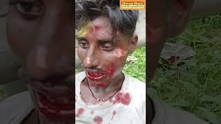 ‌ पूर्णिया हरदा पुल के निकट शिव मंदिर मंठ के आगे N.H 31 पर हुआ एक्सीडेंट #video युवक का उम्र 26 वर्ष