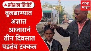 Special Report Buldhana Hairfall isssue : बुलढाण्यात अज्ञात आजारानं तीन दिवसात पडतंय टक्कल