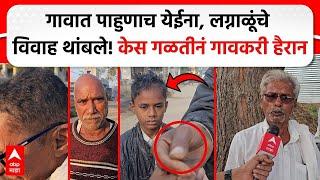 Buldhana Hair Fall : गावात पाहुणाच येईना, लग्नाळूंचे विवाह थांबले! केस गळतीनं गावकरी हैरान