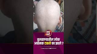 बुलढाण्यातील लोक अचानक टकले का झाले? | Buldhana | Shegaon | Kathora | Hingana | Bondgaon