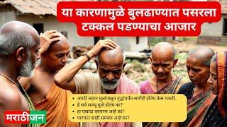 या कारणामुळे बुलढाण्यात पसरला टक्कल पडण्याचा आजार | Buldhana Hair Fall