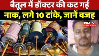 Chinese Manjha Ban : Betul में Doctor की कट गई नाक, लगे 10 टांके, जानें वजह | Breaking News | MP