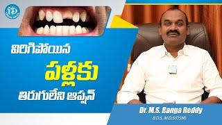 విరిగిపోయిన పళ్లకు తిరుగులేని బెస్ట్ ఆప్షన్ | Dr MS Ranga Reddy | Dentist | Dental Problems | Health