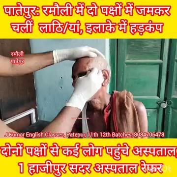 Patepur News: दो पक्षों के बीच चली लाठि/यां, आधा दर्जन लोग पहुंचे अस्पताल Latest Hindi News