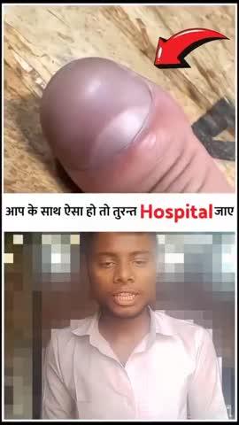 आपके अंगुली के साथ ऐसा हो तो, 🚨 तुरंत हॉस्पिटल चले जाना 😱 Nail Clubbing