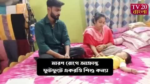 মারণ রোগে আক্রান্ত ফুটফুটে একরত্তি শি*শু কন্যা, ১৬ কোটি টাকা ব্যয় করলে বেঁ*চে যাবে প্রা*ণ