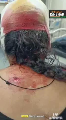 बरही: बाउंड्रीवाल विवाद में बुजुर्ग दंपत्ति और उनकी बेटी पर जानलेवा हमला, पुलिस ने FIR दर्ज की
संवाददाता बालकिशन नामदेव
कटनी। बरही थाना क्षेत्र के विजयराघवगढ़ रोड पर बाउंड्रीवाल विवाद को लेकर एक बुजुर्ग दंपत्ति और उनकी बेटी पर पड़ोसी परिवार के करीब आधा दर्जन लोगों ने हमला कर दिया। इस हमले में एक ही परिवार के तीन सदस्य घायल हुए। घटना गुरुवार शाम करीब 4:50 बजे की है। पुलिस ने शिकायत मिलते ही मामला दर्ज कर लिया है।
घटना का विवरण
शिकायतकर्ता उत्तमचंद गुप्ता, जो स्थानीय स्तर पर दुकान चलाते हैं, ने बताया कि उनके खाली प्लॉट में बनी बाउंड्रीवाल को लेकर विवाद चल रहा था। इसी दौरान पड़ोसी पक्ष के कृष्ण कुमार सोनी, सुनीता सोनी, राजा सोनी, राजकुमारी सोनी और प्रकाशचंद सोनी की पत्नी ने फावड़ा, लाठी और गैंती लेकर उनके घर में घुसकर हमला कर दिया। हमलावरों ने उनके प्लॉट की बाउंड्रीवाल भी तोड़ दी।
घायलों की स्थिति
हमले में उत्तमचंद गुप्ता, उनकी पत्नी सुनीता गुप्ता और उनकी बेटी प्रियंका घायल हुई हैं।
उत्तमचंद गुप्ता को कमर, चेहरा और पीठ पर चोटें आईं।
सुनीता गुप्ता को फावड़ा और गैंती से मारा गया, जिससे कंधा और कलाई घायल हुई।
प्रियंका के चेहरे और आंख के नीचे चोट पहुंची।
हमलावरों की धमकी
शिकायत में आरोप लगाया गया कि हमलावर गाली-गलौज करते हुए जान से मारने की धमकी देकर मौके से भाग गए।
पुलिस की कार्रवाई
घायलों को उपचार के लिए शासकीय अस्पताल भेजा गया और उनका मेडिकल परीक्षण कराया गया। पुलिस ने घर में घुसकर हमला करने, गंभीर मारपीट और जान से मारने की धमकी देने सहित अन्य धाराओं में FIR दर्ज कर ली है। मामले की जांच जारी है और आरोपियों की भूमिका की पुष्टि की जा रही है।