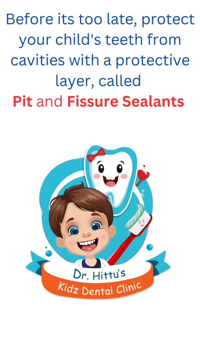 Pit and fissure sealants in an eight year old girl
First permanent molars erupted at the age of 6-7 years, ideally should be seal at that time only
But as you can see in the video, child at 8 years got black lines which is initial cavity in fissures and we don't seal it now will increase with time, so better to protect them at earlier stage
For more information contact at 9205524886, Dr
Hittu's Kidz Dental Clinic