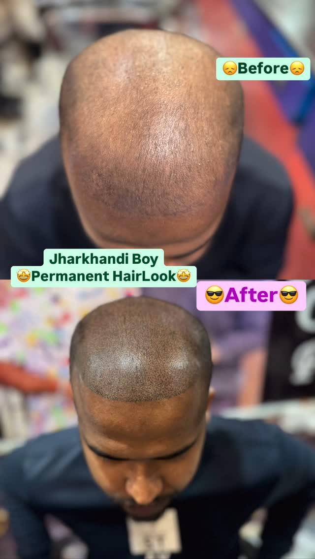 Jharkhandi Boy Permanent HairLook💯%😎🤩🔥…
hair_artist_bittu5871 natraj_family_sallon 
: