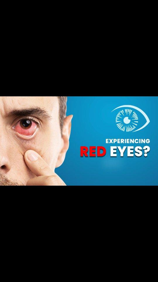 Red eyes can result from various causes like fatigue, allergies, infections, or excessive screen time
Ignoring these symptoms can lead to more serious eye health issues
Visit: www.srisainethralaya.com
Email: infosrisainethralaya.com
Contact: +91 80080 60217