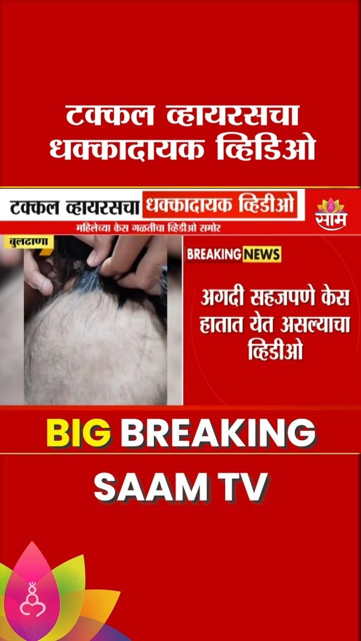 Buldhana Takkal Virus: बुलढाण्यातील महिलेच्या केस गळतीचा व्हिडीओ समोर 

#buldhana #takkalvirus #saamtvnews #viralvideo #hairloss us

Buldhana Takkal Virus: Video of woman losing hair in Buldhana surfaces
A shocking video has emerged from Buldhana, showing a woman experiencing severe hair loss, allegedly due to the mysterious "Takkal Virus
The incident has sparked concerns among locals, prompting health authorities to investigate the matter urgently